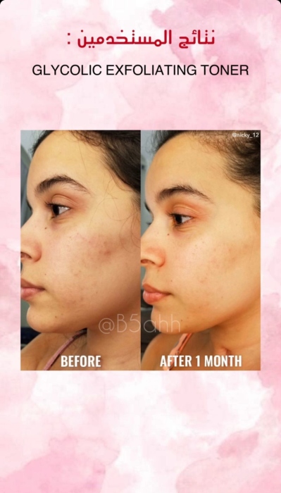 Good molecules, GLYCOLIC EXFOLIATING TONER  جود موليكيولز، تونر حمض الجليكوليك للتقشير 